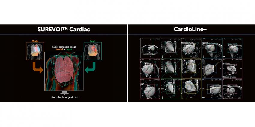 Intelligent technology Easy Tech-Fast — SUREVOI ™ Cardiac и CardioLine +