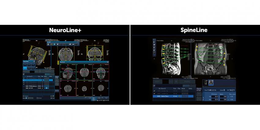 Intelligent technology Easy Tech-Fast — NeuroLine + и SpineLine