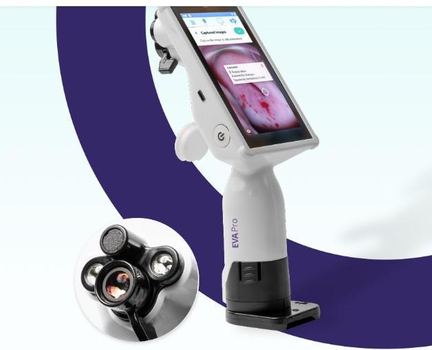 EVA Pro Mobile Digital Colposcope, 49% OFF | eccosis.com.co