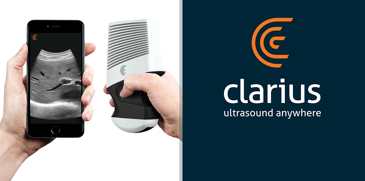 Clarius launches new wireless scanners for emergency diagnostics