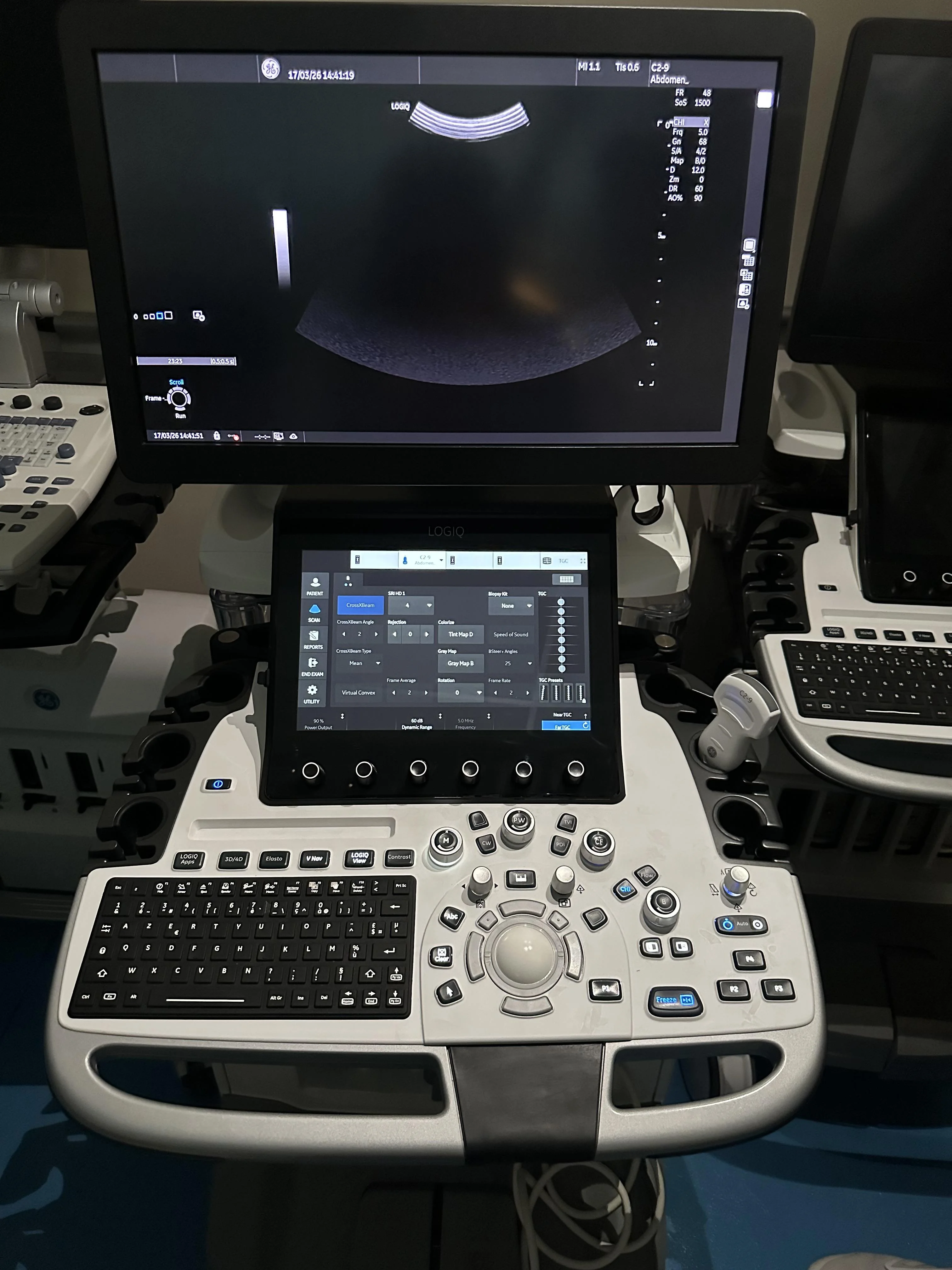 GE LOGIQ E10s Ultrasound Machine