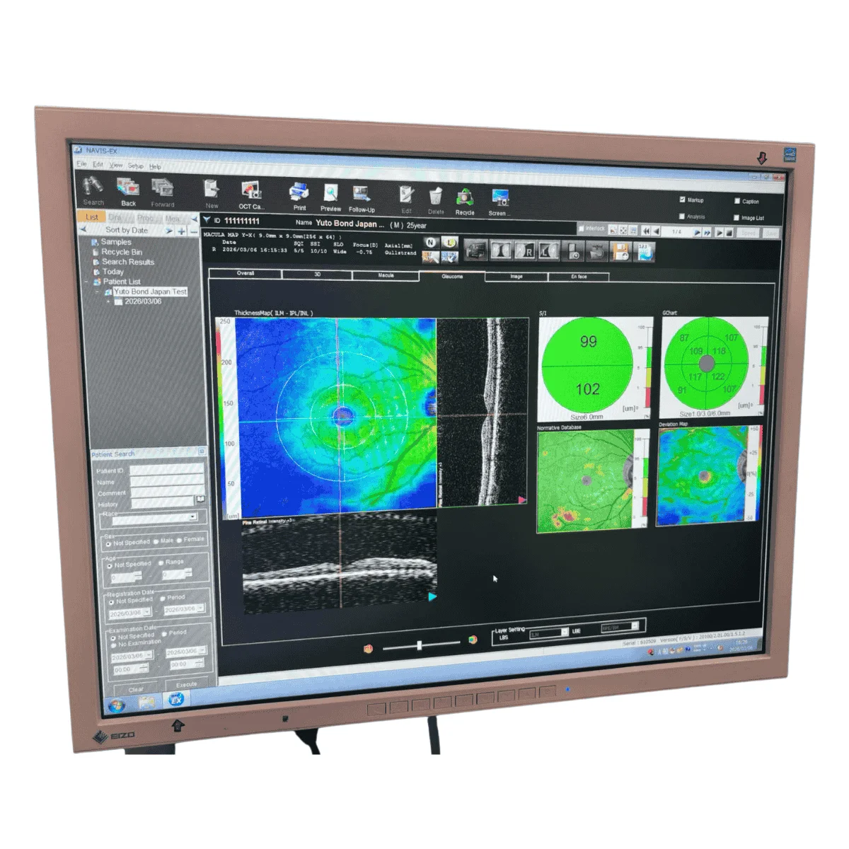 Oct Italy Sell OCT tomograph NIDEK RS-3000 Advance 2014 (Italy) | Bimedis