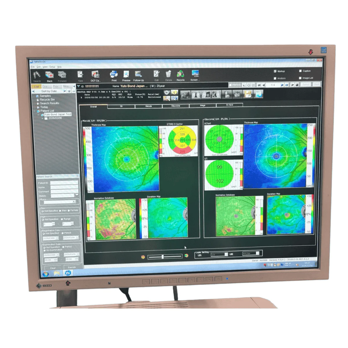 Oct Italy Sell OCT tomograph NIDEK RS-3000 Advance 2014 (Italy) | Bimedis