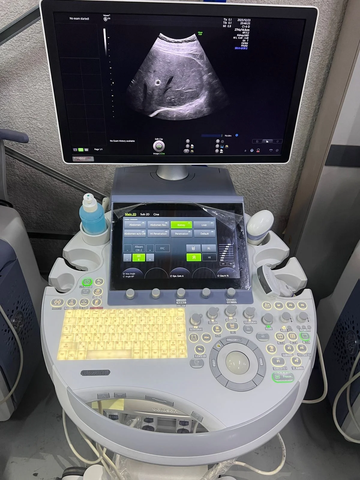 GE Voluson E10 Ultrasound Machine