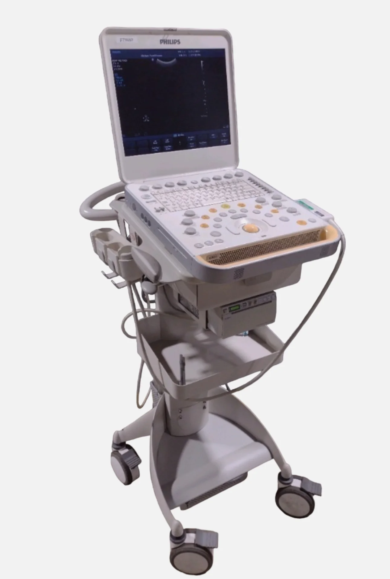 PHILIPS CX50 Ultrasound Machine