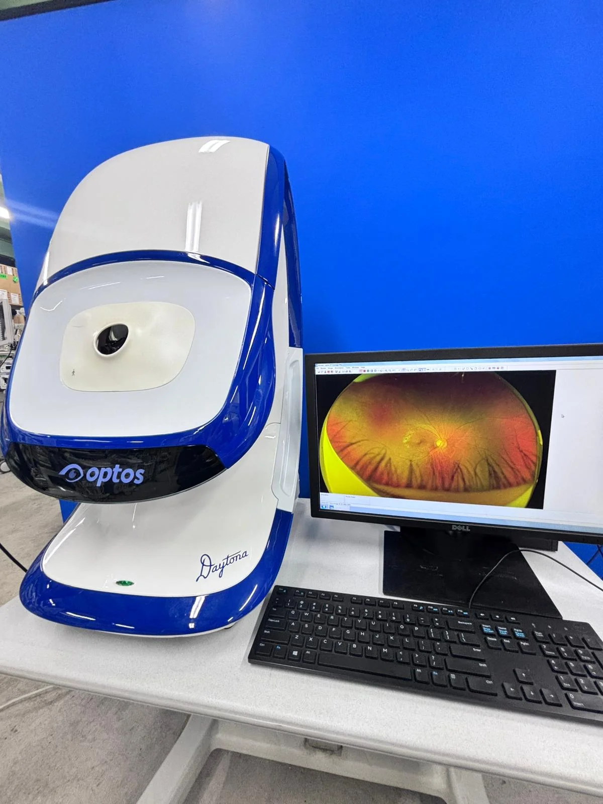Sell Corneal Topographer OPTOS Daytona 2017 (United States) | Bimedis