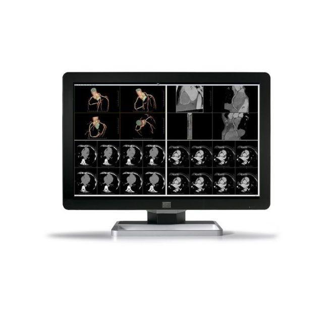 Sell Diagnostic Display BARCO Coronis Fusion 6MP LED (MDCC-6430 ...