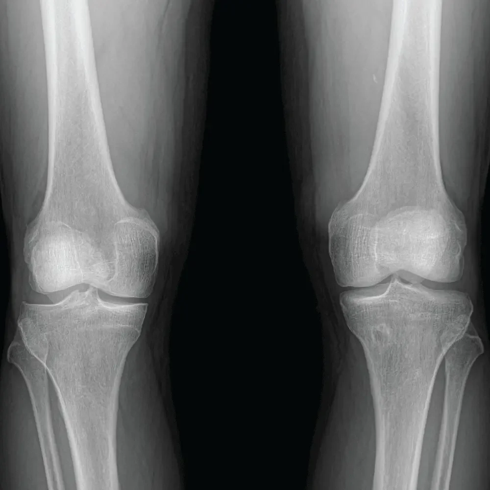 Eos X Raz Sell X-ray machine EOS IMAGING EOSedge 2022 (France) | Bimedis