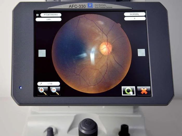 Sell Retinal camera NIDEK AFC-330 2017 (France) | Bimedis