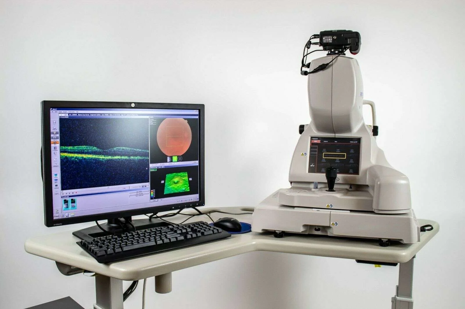 Marco Reticam Oct Machine Sell OCT tomograph TOPCON 3D OCT-2000 (United Arab Emirates) | Bimedis