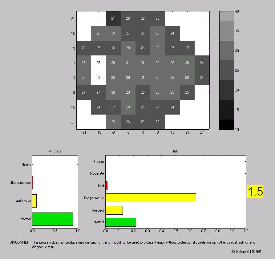 Sell Perimeter OCULUS Centerfield 2 (Germany) | Bimedis