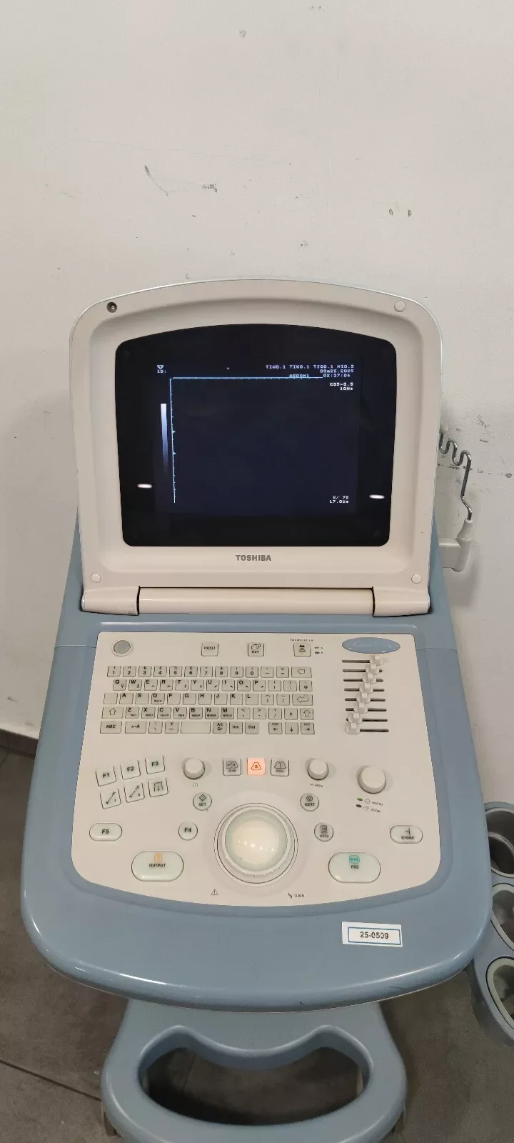 Sell Ultrasound Machine TOSHIBA Famio 5 (SSA-510A) 2006 (Germany) | Bimedis