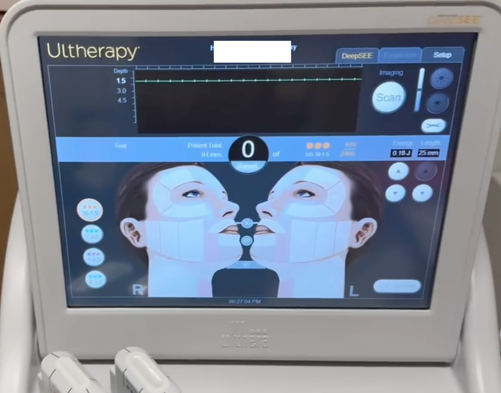 Sell Face-lift Machine ULTHERA Ultherapy 2024 (United States) | Bimedis