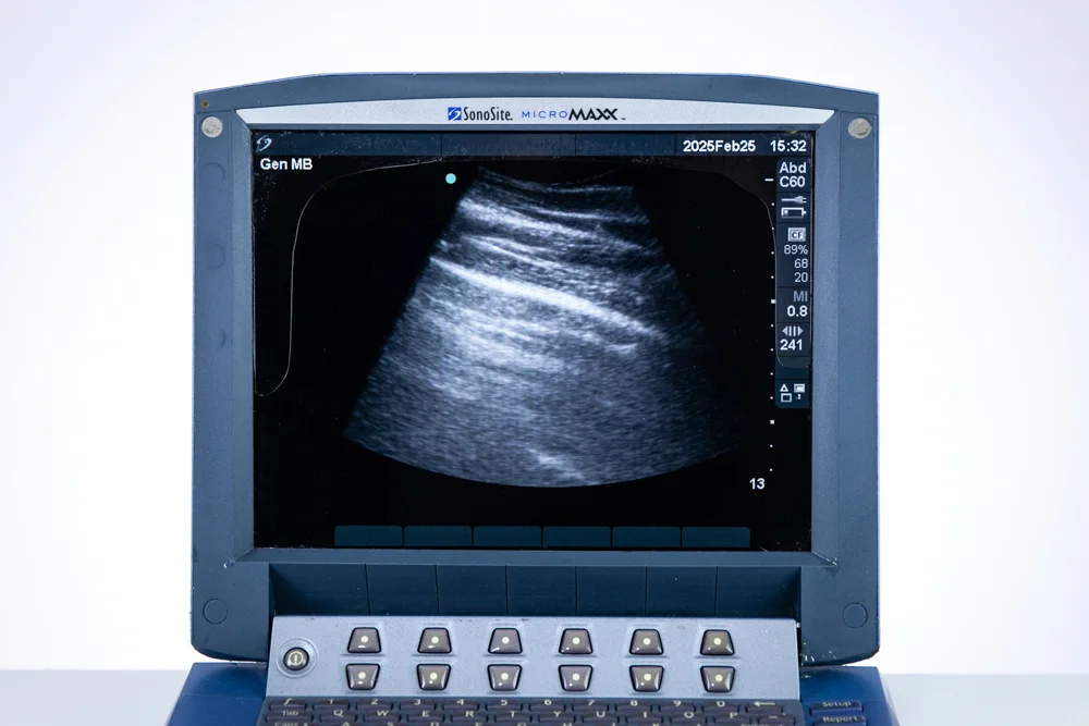 Micromaxx Sell Ultrasound Machine SONOSITE MicroMaxx 2007 (Poland) | Bimedis