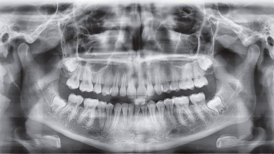 Ray Duerr Sell PANORAMIC X-RAY SYSTEM (Orthopantomograph) DÜRR DENTAL VistaVox S ...