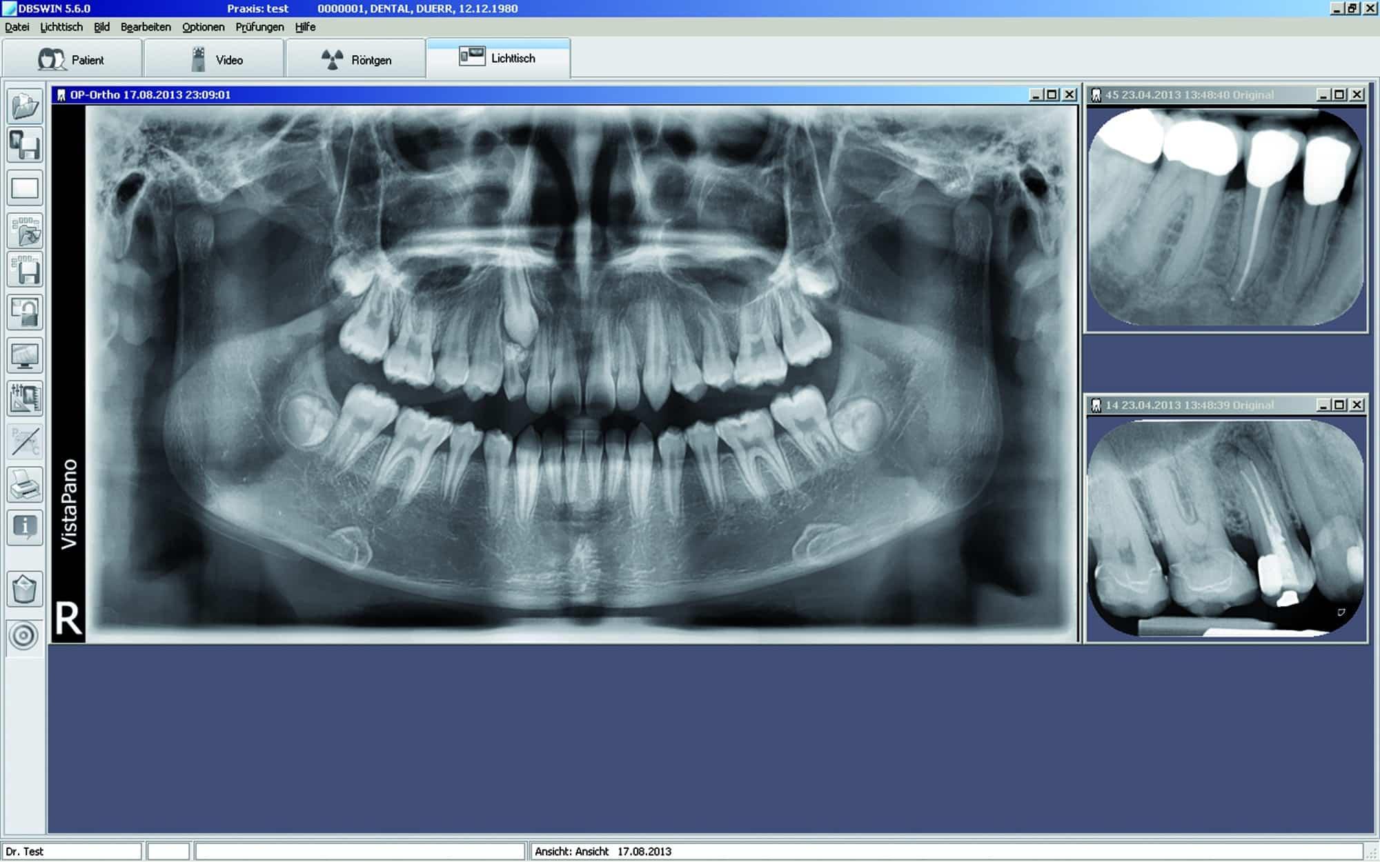 Ray Duerr Sell PANORAMIC X-RAY SYSTEM (Orthopantomograph) DÜRR DENTAL VistaPano S ...