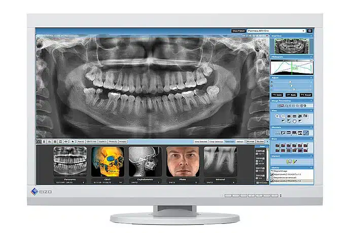 Ray Duerr Sell PANORAMIC X-RAY SYSTEM (Orthopantomograph) DÜRR DENTAL VistaPano S ...