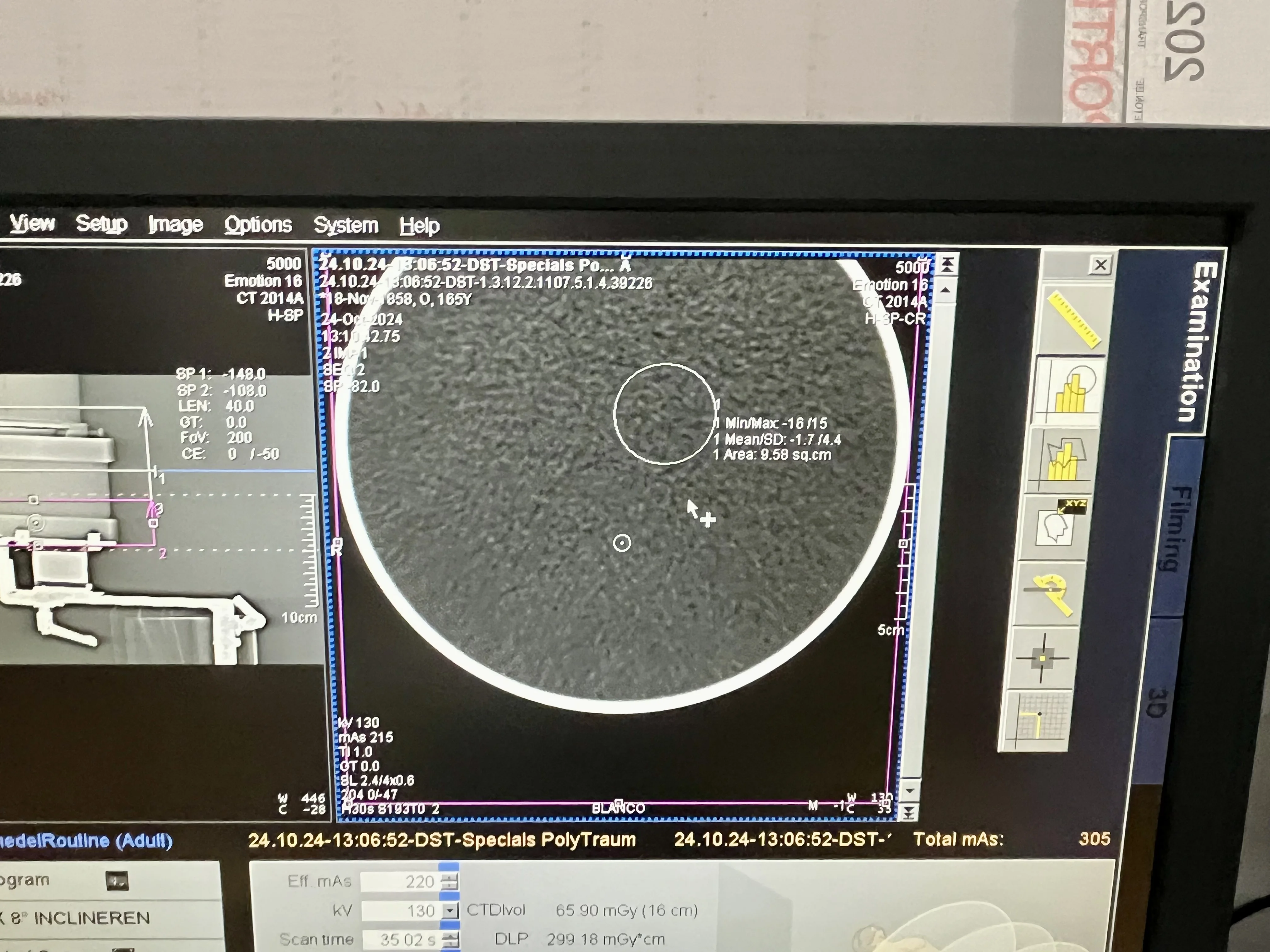 Emption Scan Sell CT Scanner on Bimedis CT Scanner SIEMENS SOMATOM Emotion 16 2006 ...