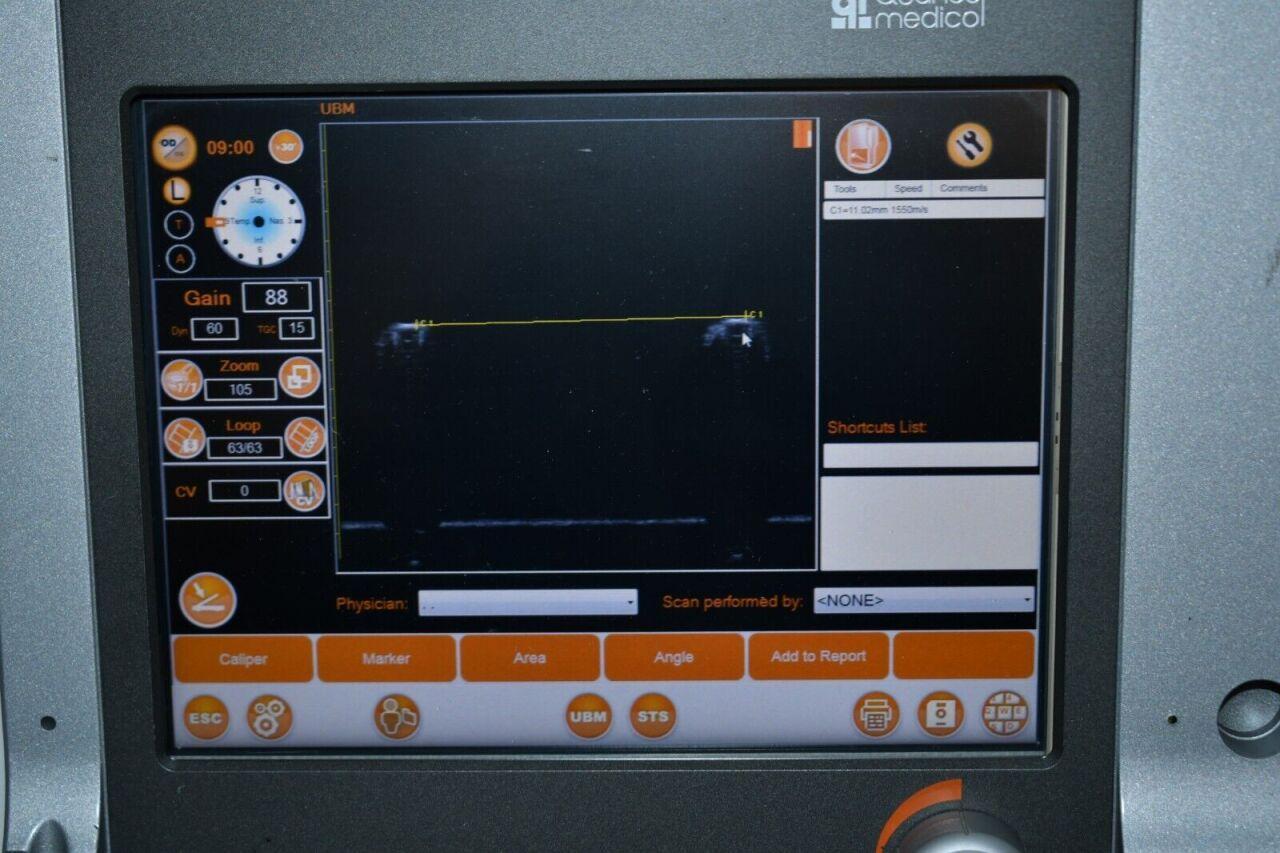 Sell A-Scan QUANTEL MEDICAL Compact Touch (United States) | Bimedis