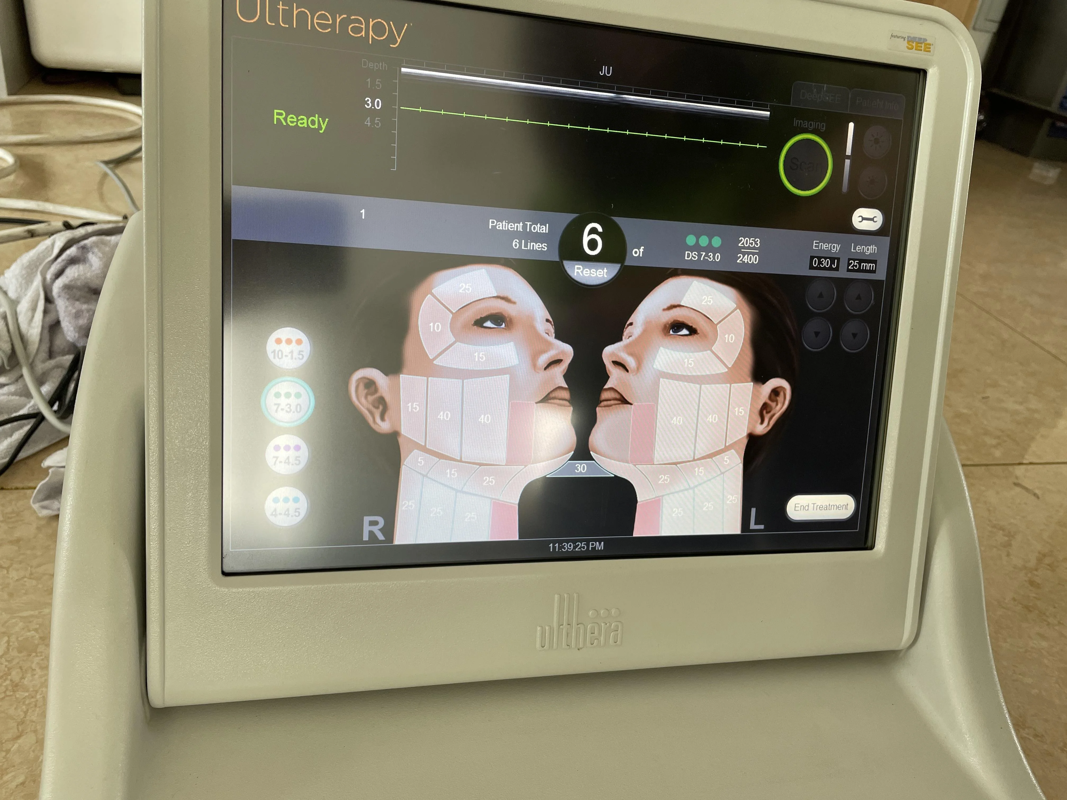Sell Face-lift Machine ULTHERA Ultherapy 2018 (China) | Bimedis