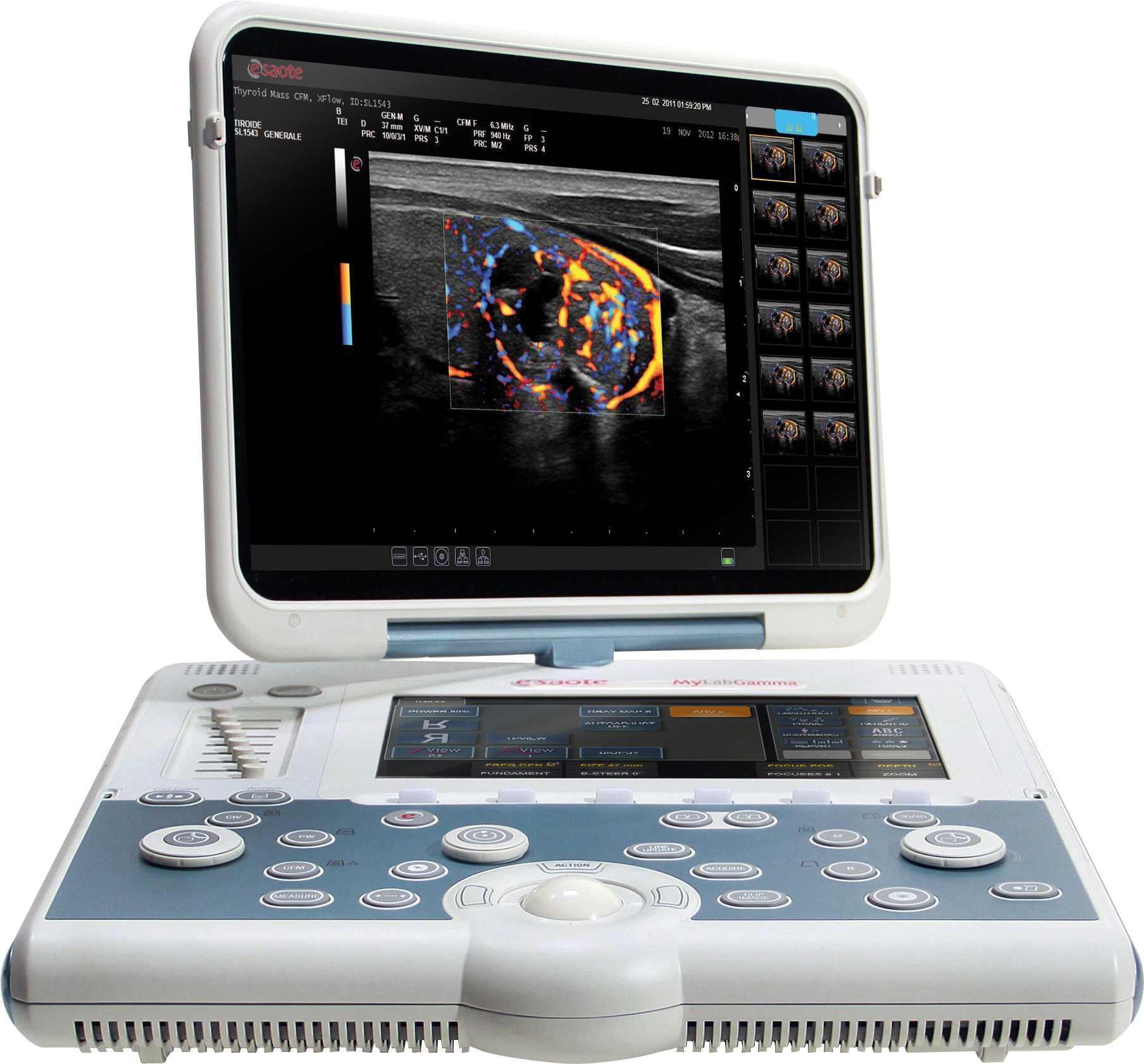 Sell Ultrasound Machine ESAOTE MyLab Gamma 2016 (United Arab Emirates ...