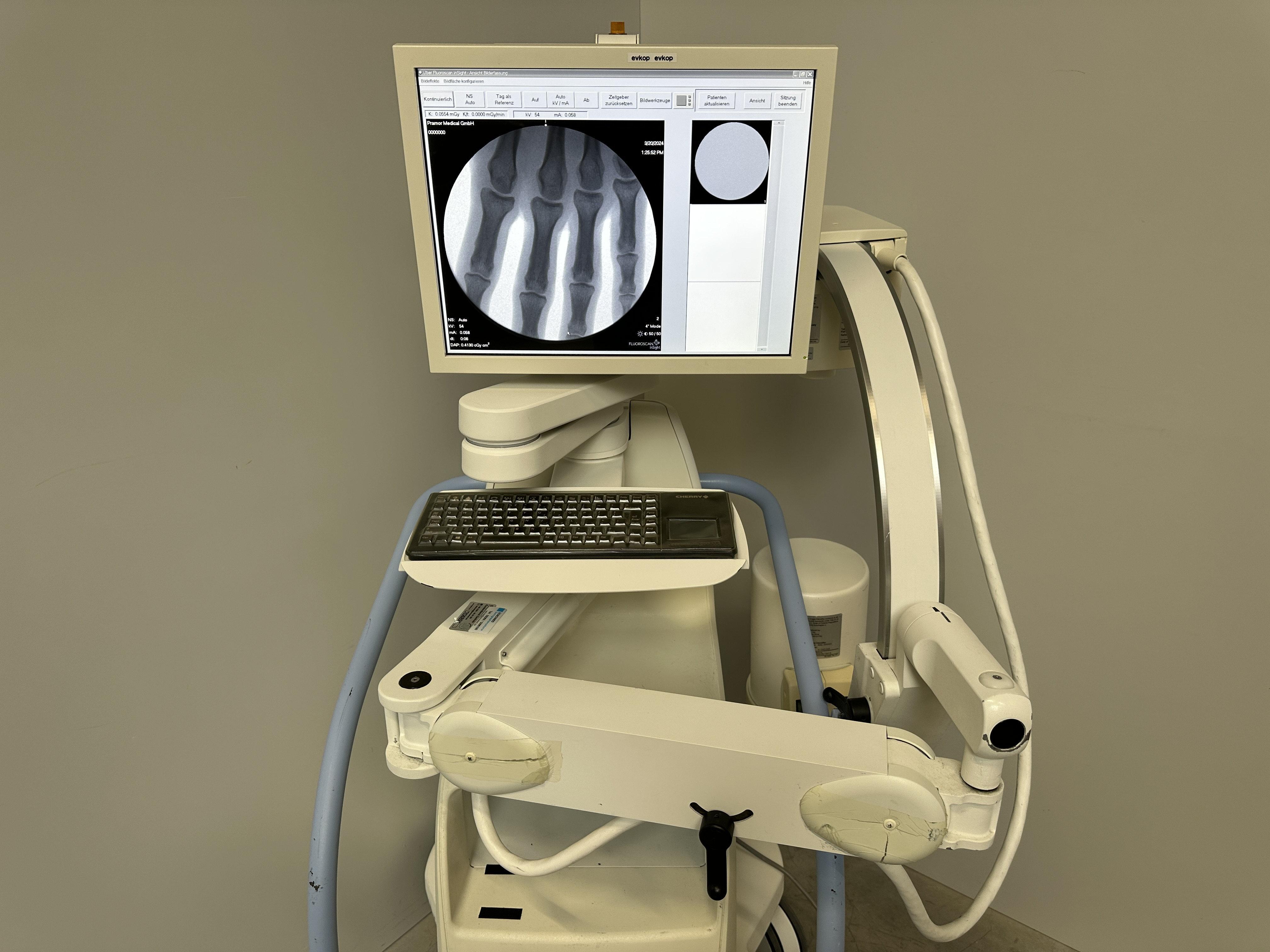 Hologic Miniview Sell C-arm HOLOGIC Fluoroscan Insight 2 Mini 2010 (Germany) | Bimedis