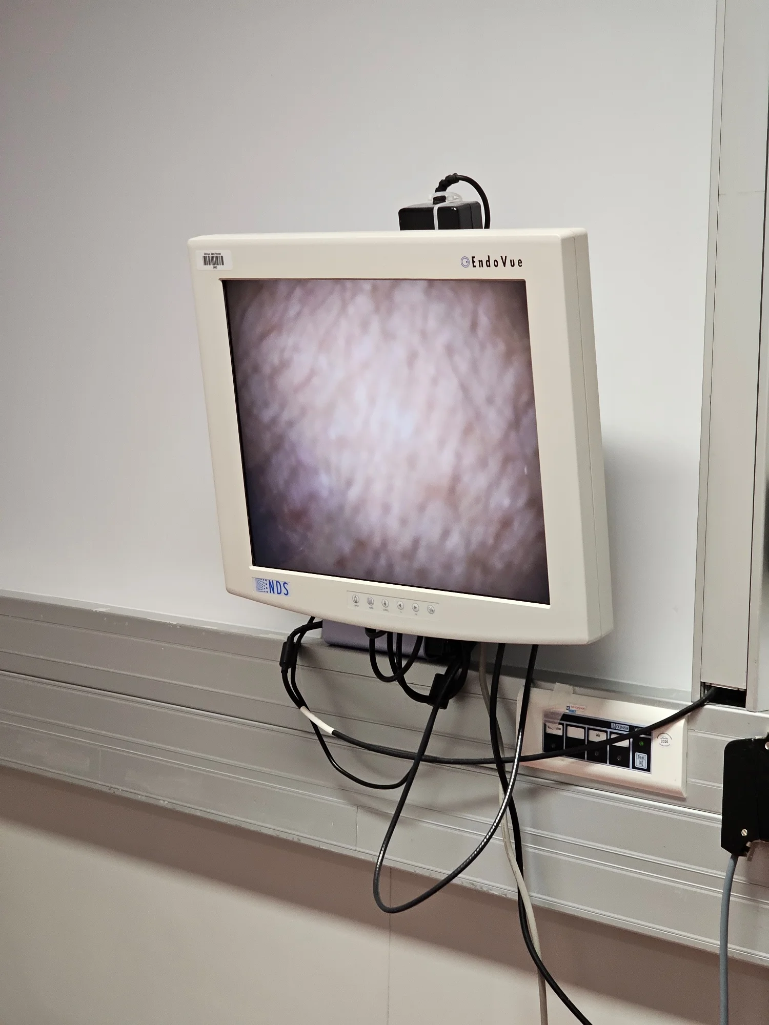 Sell O/R Microscope on Bimedis O/R Microscope ZEISS OPMI Lumera T 2010 ...