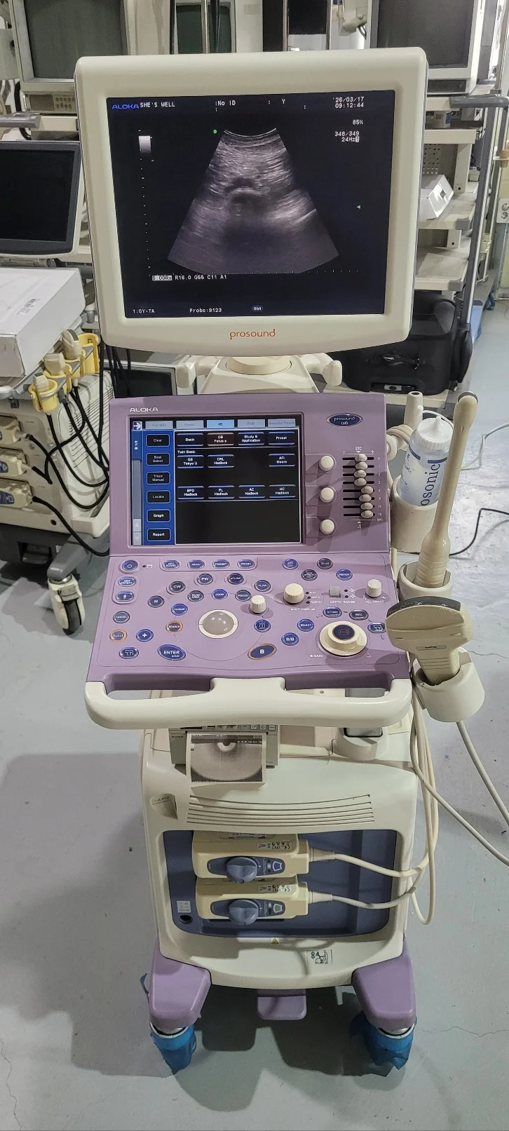 Sell Ultrasound Machine ALOKA ProSound Alpha 6 (United States) | Bimedis