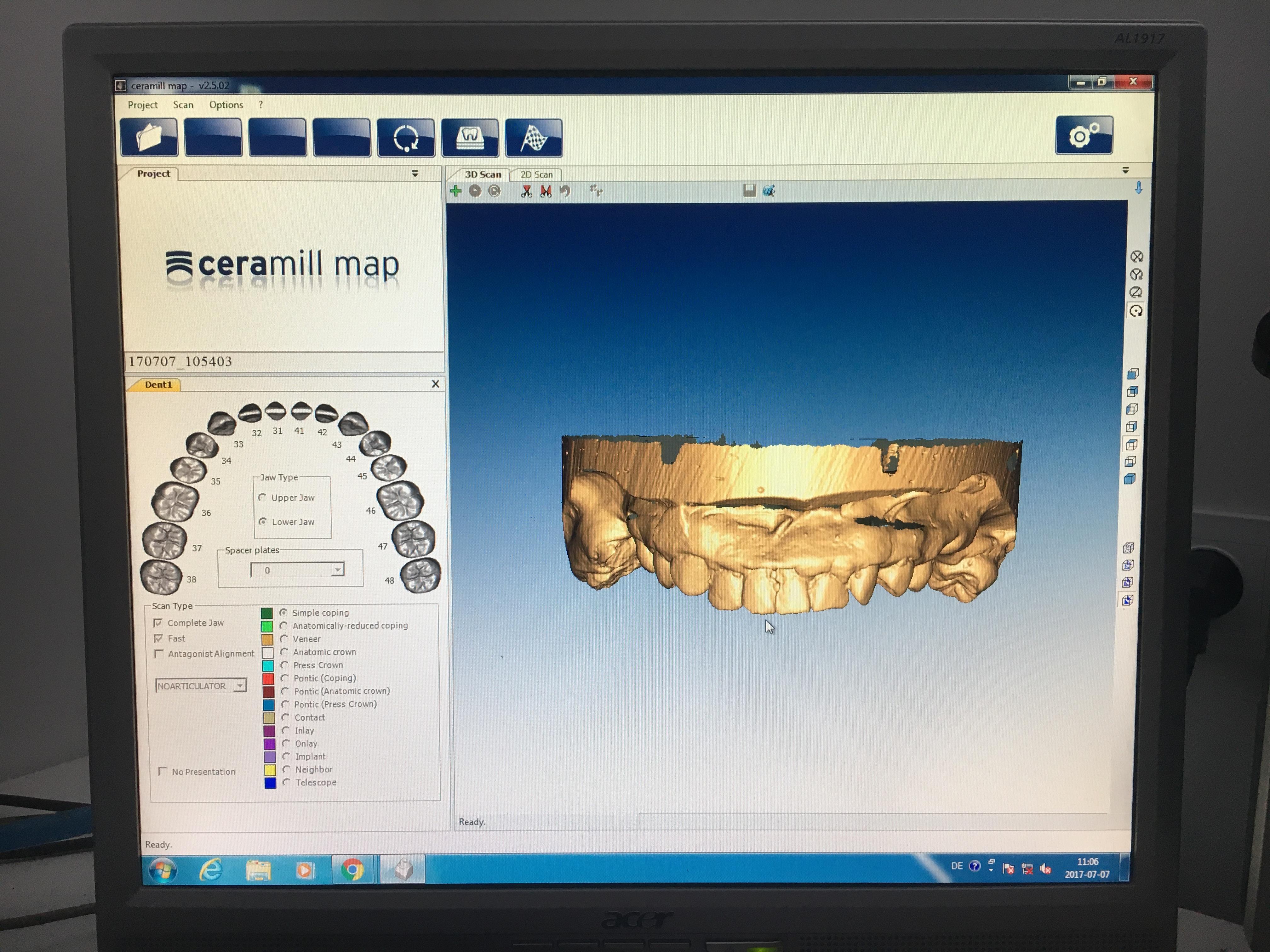 Sell 3D dental scanner AMANN GIRRBACH Ceramill MAP300 (Poland)