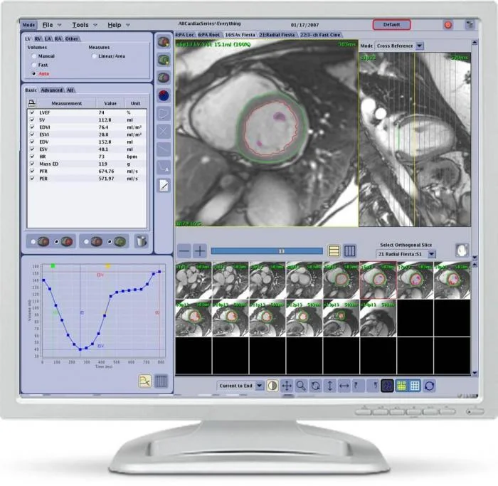 Sell CT workstation on Bimedis CT workstation GE ADW 4.7 (Denmark)
