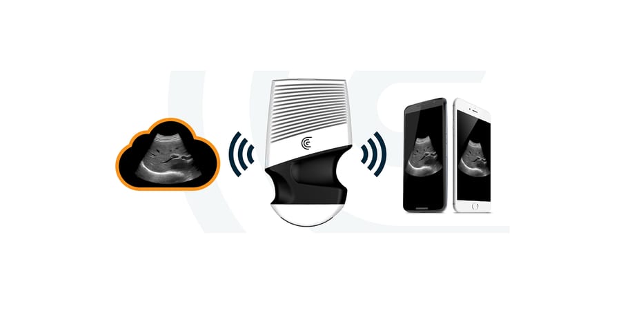 Clarius launches new wireless scanners for emergency diagnostics