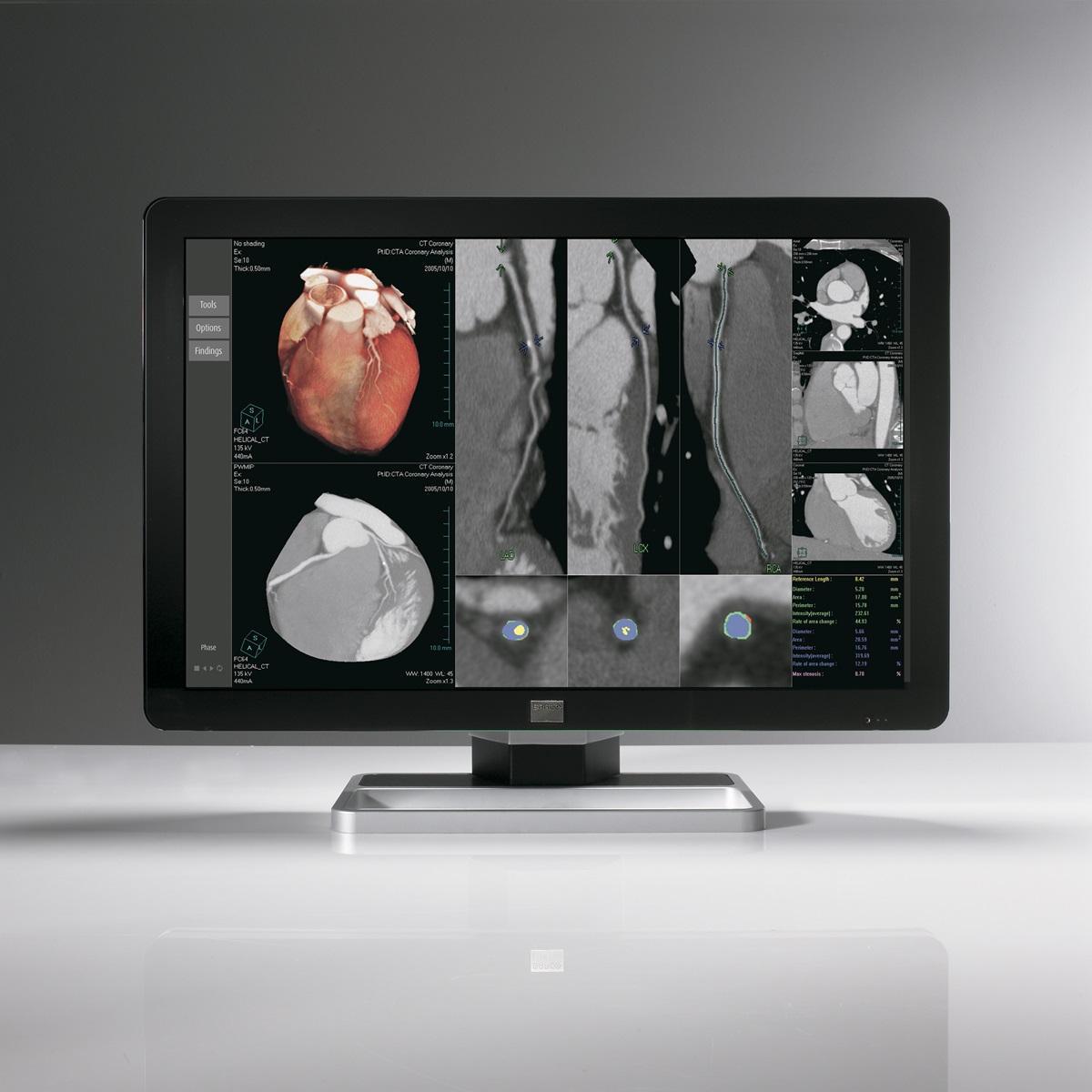 BARCO 6MP (MDCC-6230) - Bimedis - 1